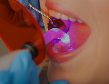 Dentist working with dental polymerization lamp in oral cavity