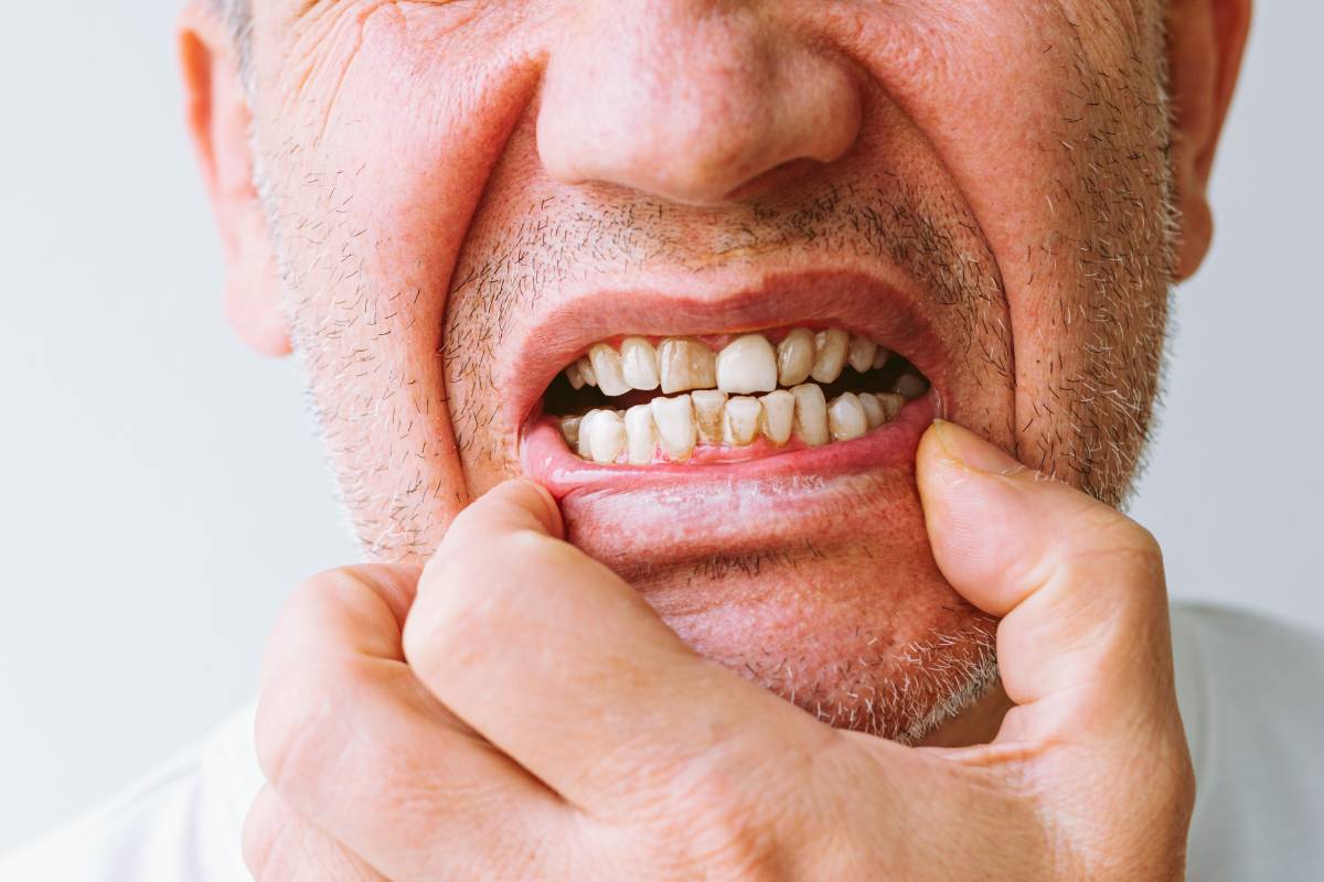 Close-up portrait of man showing teeth with tartar on white background